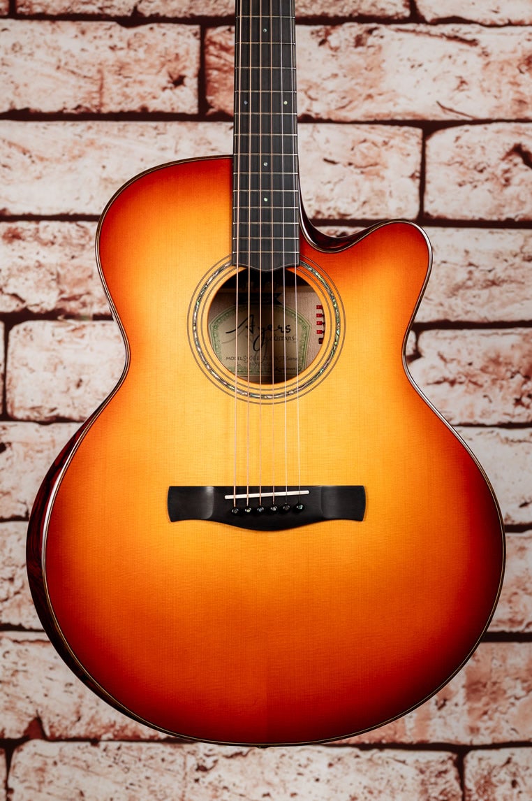 サンバースト塗装のギターの追加写真 | ギターマニアの兄を持つネット