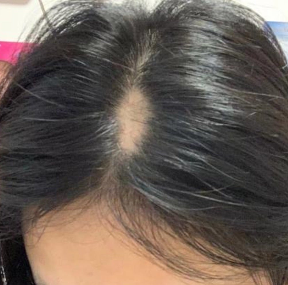 百合子ウィッグ ヘアピースサイズ選びの写真集① | 百合子ウィッグ