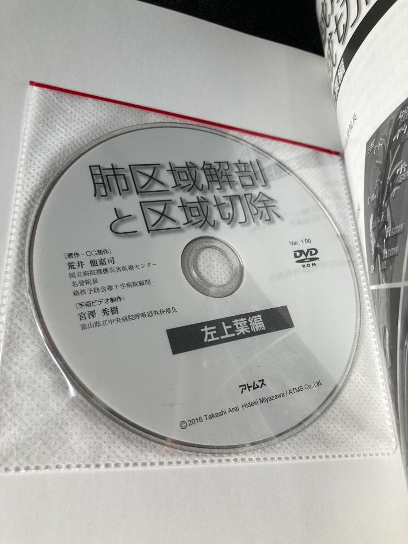 肺区域解剖と区域切除 -左上葉編- [DVD-ROM付き]