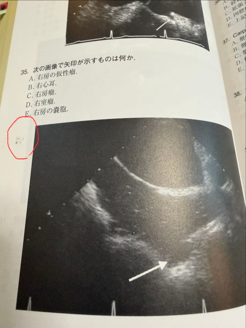 周術期経食道心エコー図