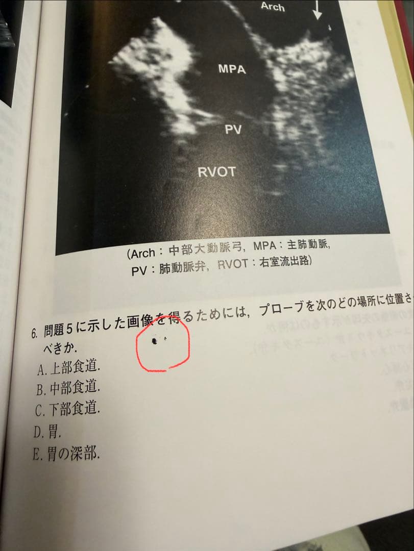 周術期経食道心エコー図