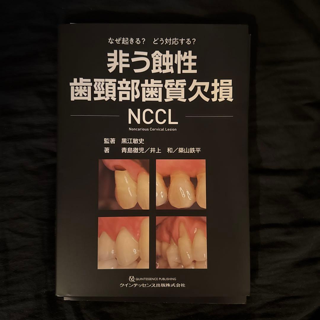非う蝕性歯頸部歯質欠損NCCL※裁断済 - メルカリ