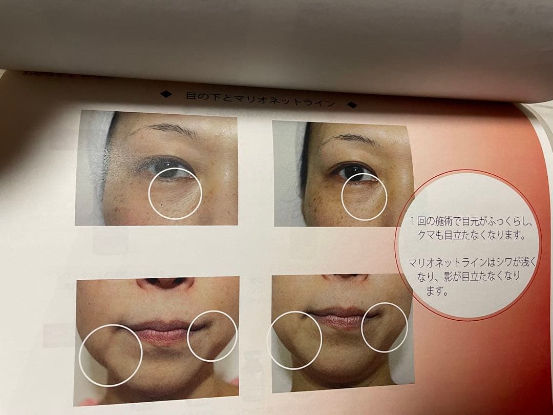 LUSTY BEAUTY 美顔器 エステ