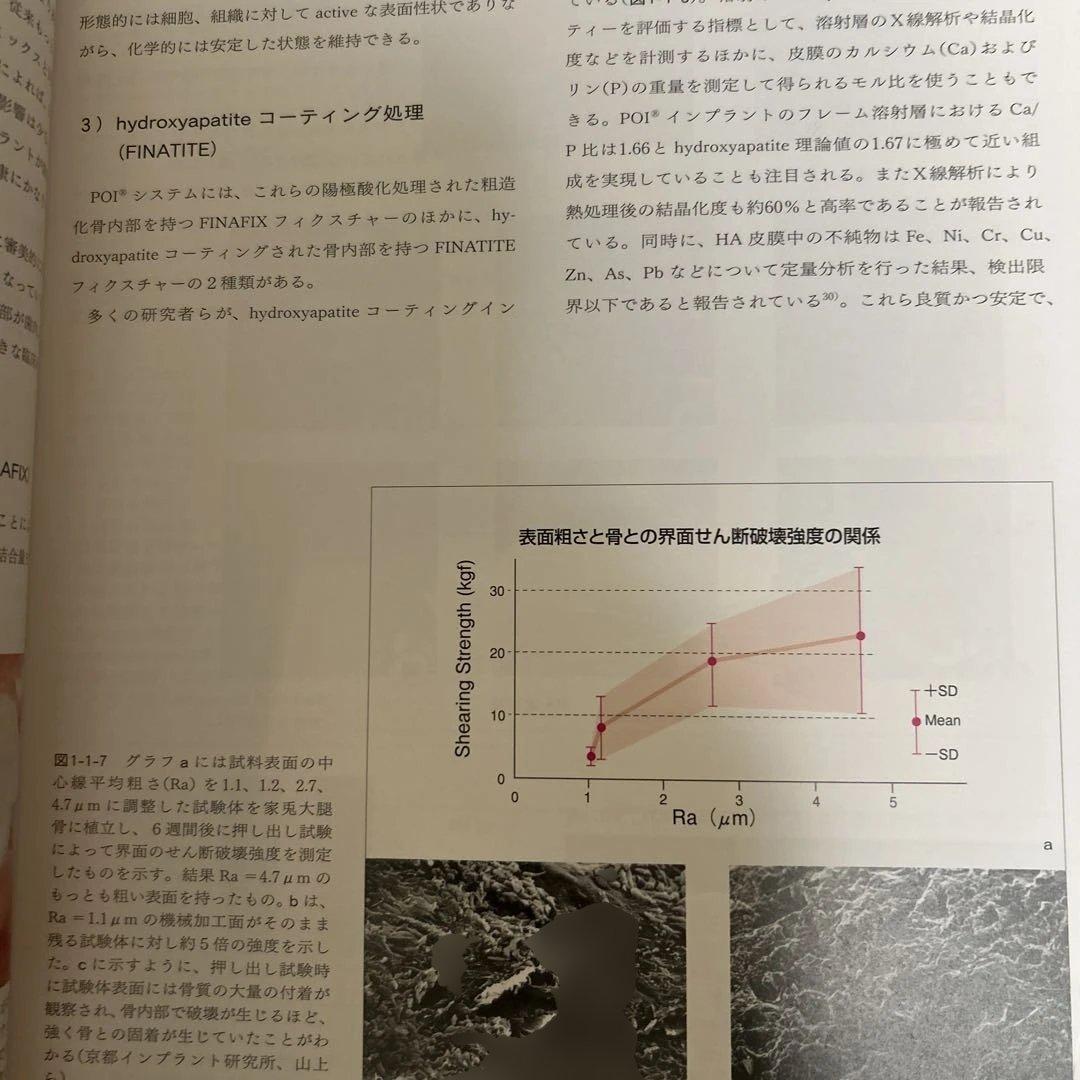 【希少】POI-EX SYSTEMの臨床 2006年版