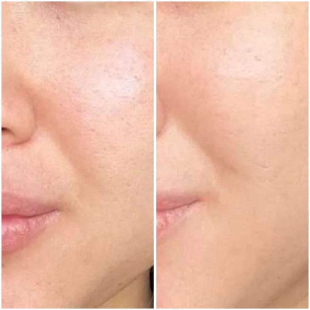 プレミアム限定】グランスキンウェリテ リミテッドエディション 2025の