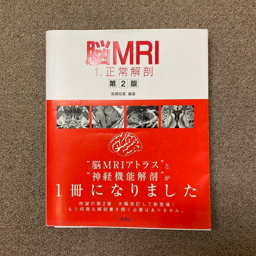 脳MRI 1(正常解剖) 脳MRI 1.正常解剖 | 高橋 昭喜, 高橋 昭喜 |本 | 通販 | Amazon