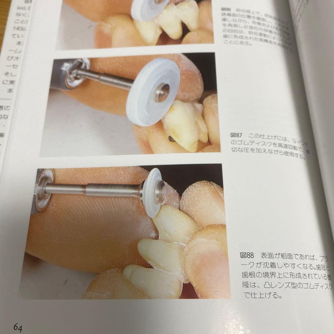 山本眞 監訳 金属焼付ポーセレン・下顎前歯部の審美的表現法 - メルカリ