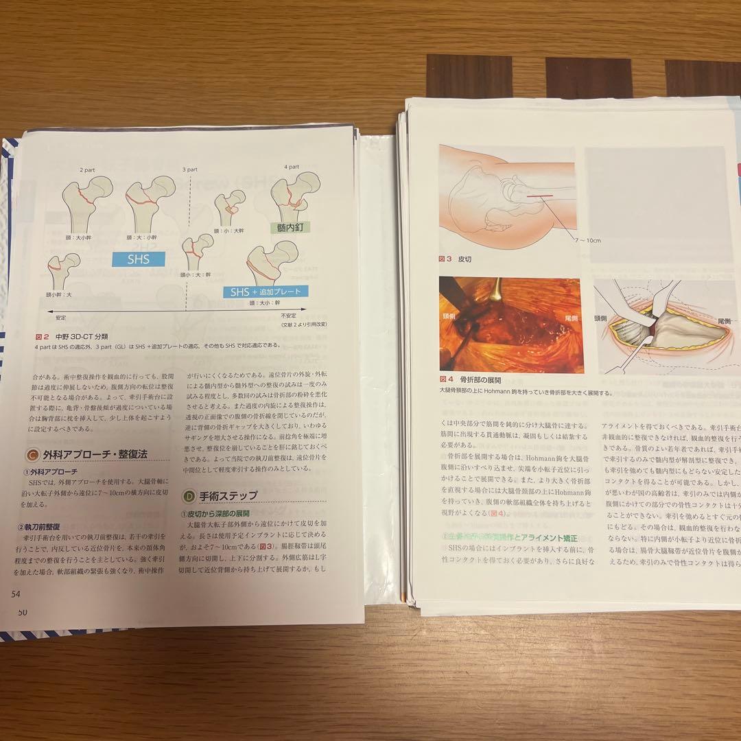 スタンダード骨折手術治療 下肢