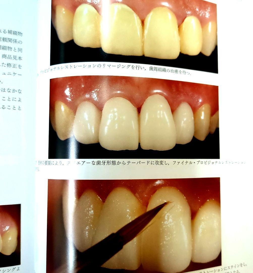 ザ・プロビジョナルレストレーションズ - メルカリ