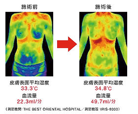 バイオウェーブ | B&F株式会社